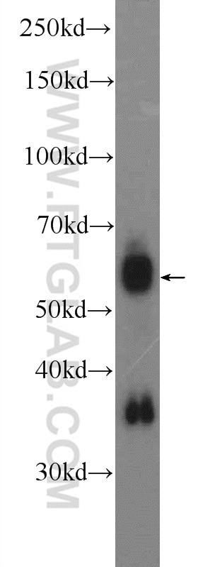 Western Blot (WB) analysis of mouse kidney tissue using PPIL2 Polyclonal antibody (12590-2-AP)