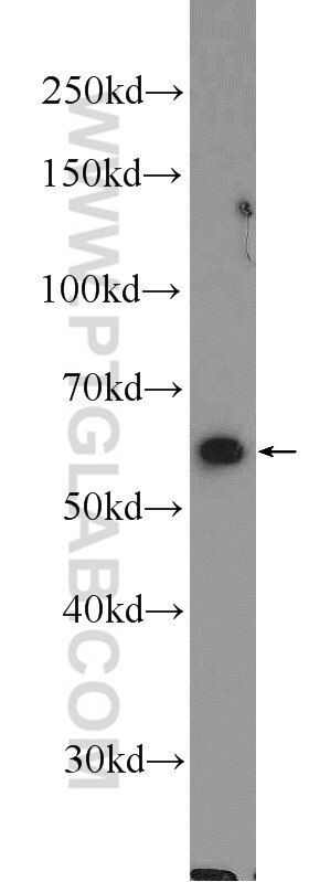 Western Blot (WB) analysis of HEK-293 cells using PPIL2 Polyclonal antibody (12590-2-AP)