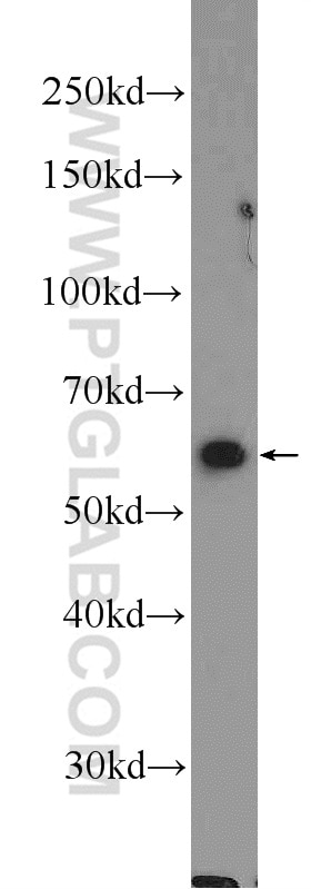 Western Blot (WB) analysis of HEK-293 cells using PPIL2 Polyclonal antibody (12590-2-AP)