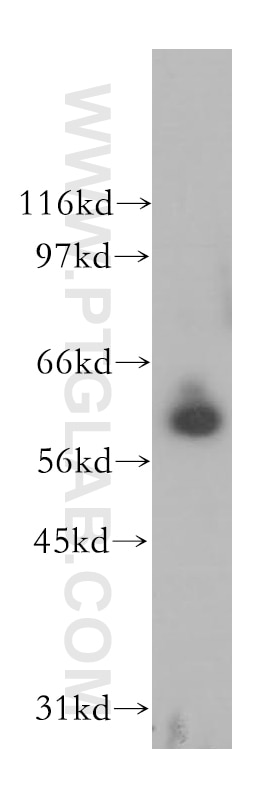 Western Blot (WB) analysis of human kidney tissue using PPIL2 Polyclonal antibody (12590-2-AP)