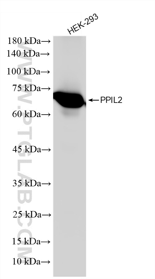 HEK-293 cells were subjected to SDS PAGE followed by western blot with 87496-1-RR (PPIL2 antibody) at dilution of 1:10000 incubated at room temperature for 1.5 hours. Western Blot (WB) analysis of HEK-293 cells using PPIL2 Recombinant monoclonal antibody (87496-1-RR)