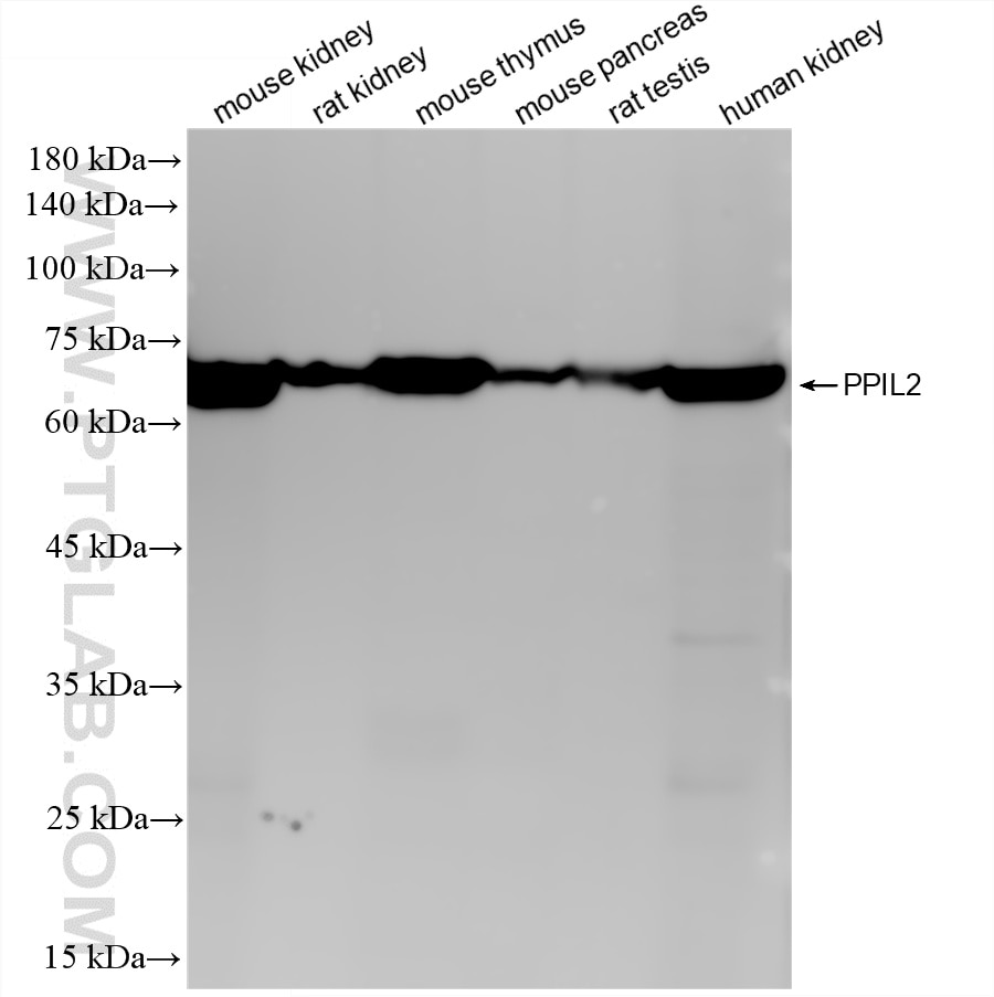 Various lysates were subjected to SDS PAGE followed by western blot with 87496-1-RR (PPIL2 antibody) at dilution of 1:10000 incubated at room temperature for 1.5 hours. Western Blot (WB) analysis of various lysates using PPIL2 Recombinant monoclonal antibody (87496-1-RR)