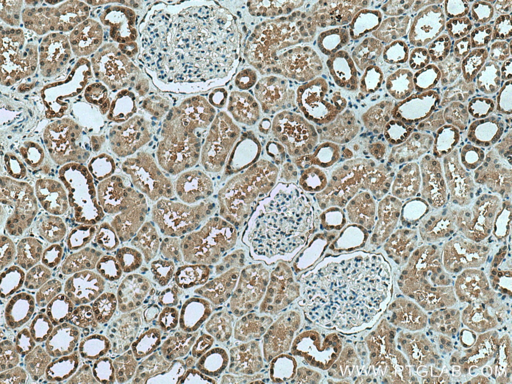 Immunohistochemistry (IHC) staining of human kidney tissue using PPIL3 Polyclonal antibody (15671-1-AP)