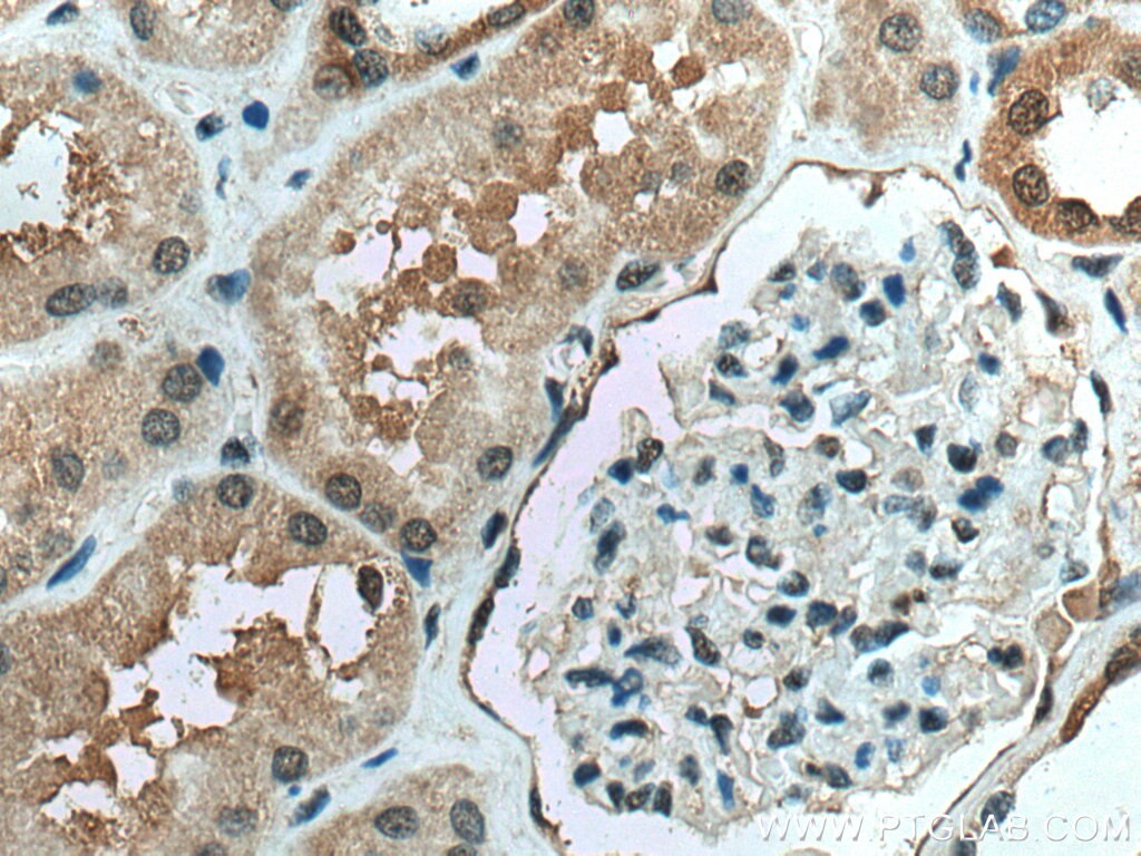 Immunohistochemistry (IHC) staining of human kidney tissue using PPIL3 Polyclonal antibody (15671-1-AP)