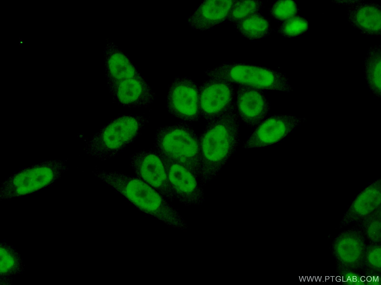 Immunofluorescence (IF) / fluorescent staining of HeLa cells using PPIL4 Polyclonal antibody (12538-1-AP)