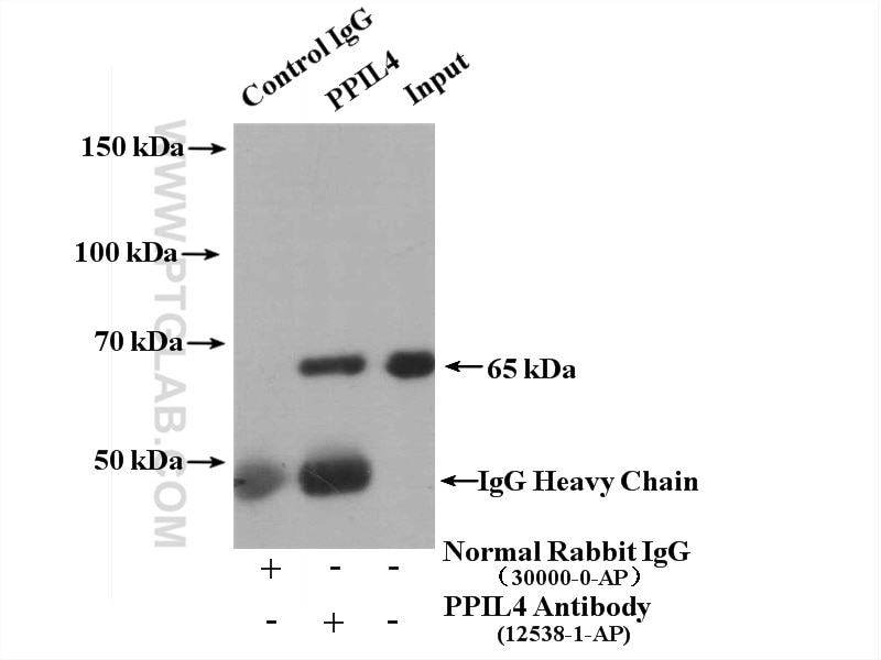 Immunoprecipitation (IP) experiment of HeLa cells using PPIL4 Polyclonal antibody (12538-1-AP)