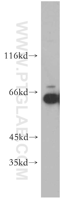 Western Blot (WB) analysis of HEK-293 cells using PPIL4 Polyclonal antibody (12538-1-AP)