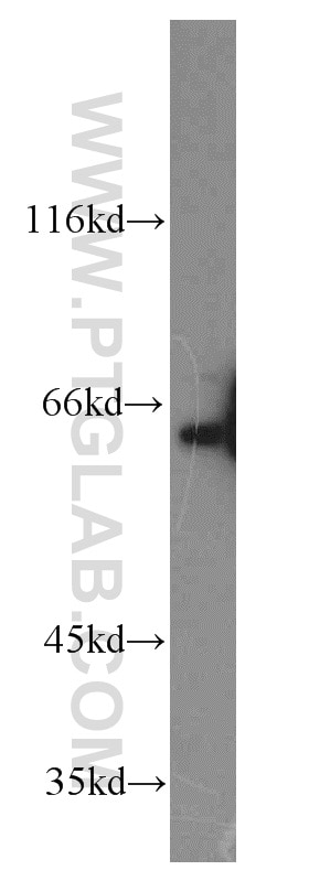 Western Blot (WB) analysis of mouse kidney tissue using PPIL4 Polyclonal antibody (12538-1-AP)