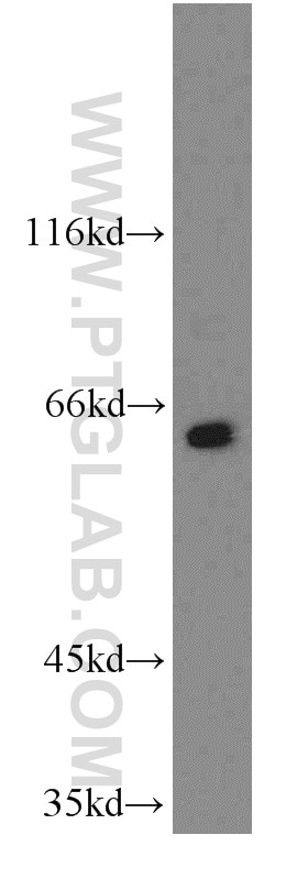 Western Blot (WB) analysis of HeLa cells using PPIL4 Polyclonal antibody (12538-1-AP)