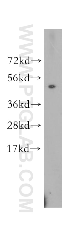 Western Blot (WB) analysis of U-937 cells using LRR 1 Polyclonal antibody (11628-1-AP)