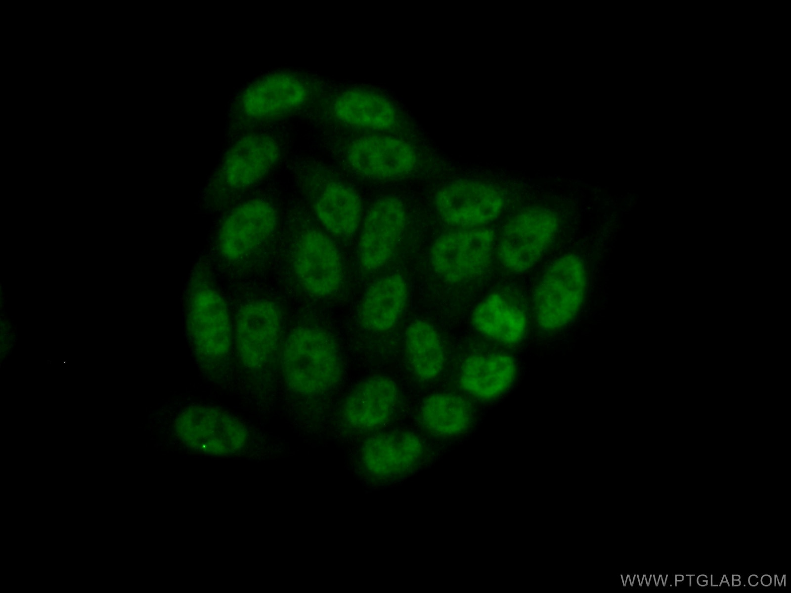 Immunofluorescence (IF) / fluorescent staining of HeLa cells using PPIL6 Polyclonal antibody (17452-1-AP)