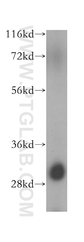 WB analysis of HeLa using 17452-1-AP