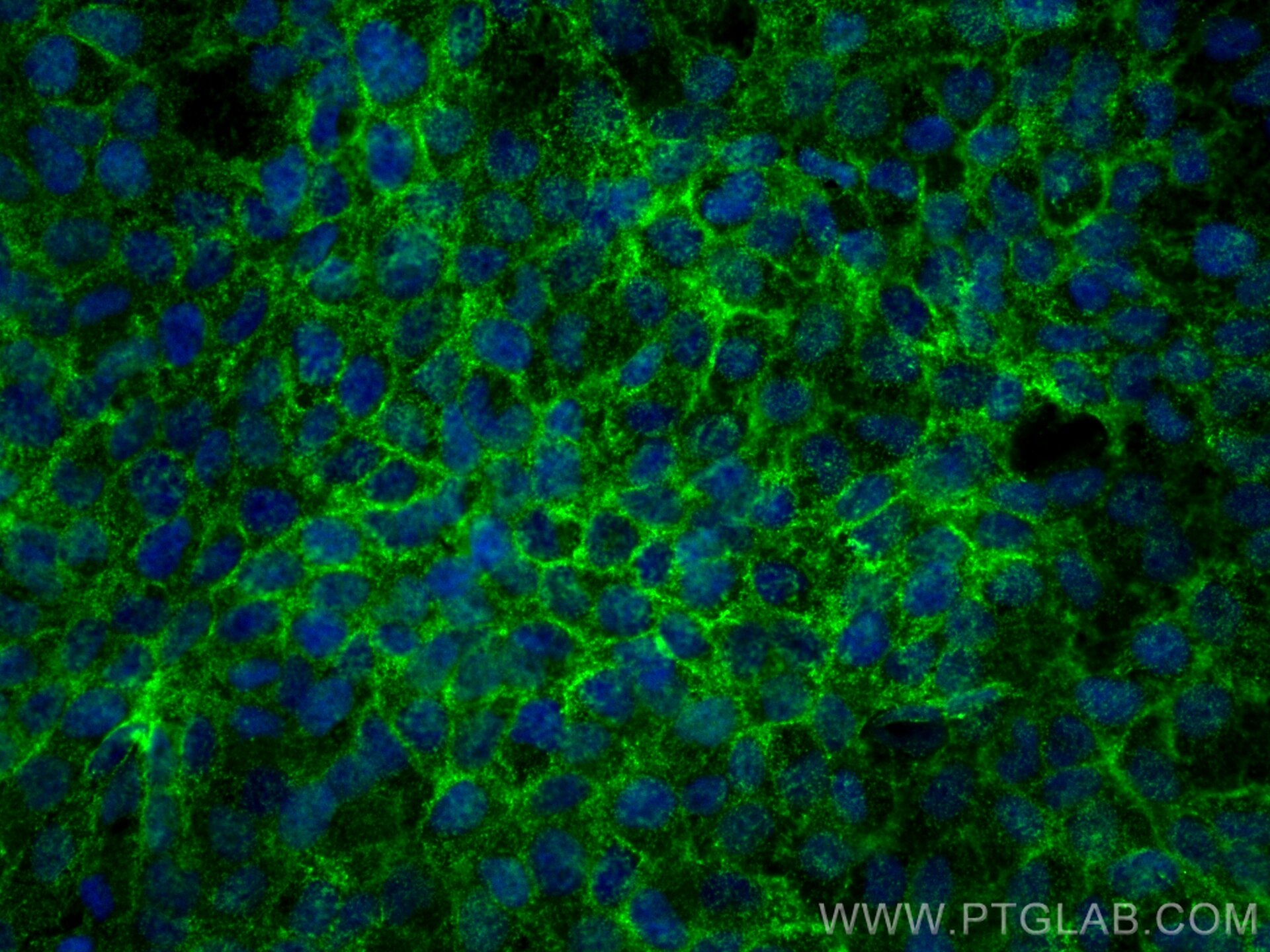Immunofluorescence (IF) / fluorescent staining of HaCaT cells using PPL Polyclonal antibody (31296-1-AP)