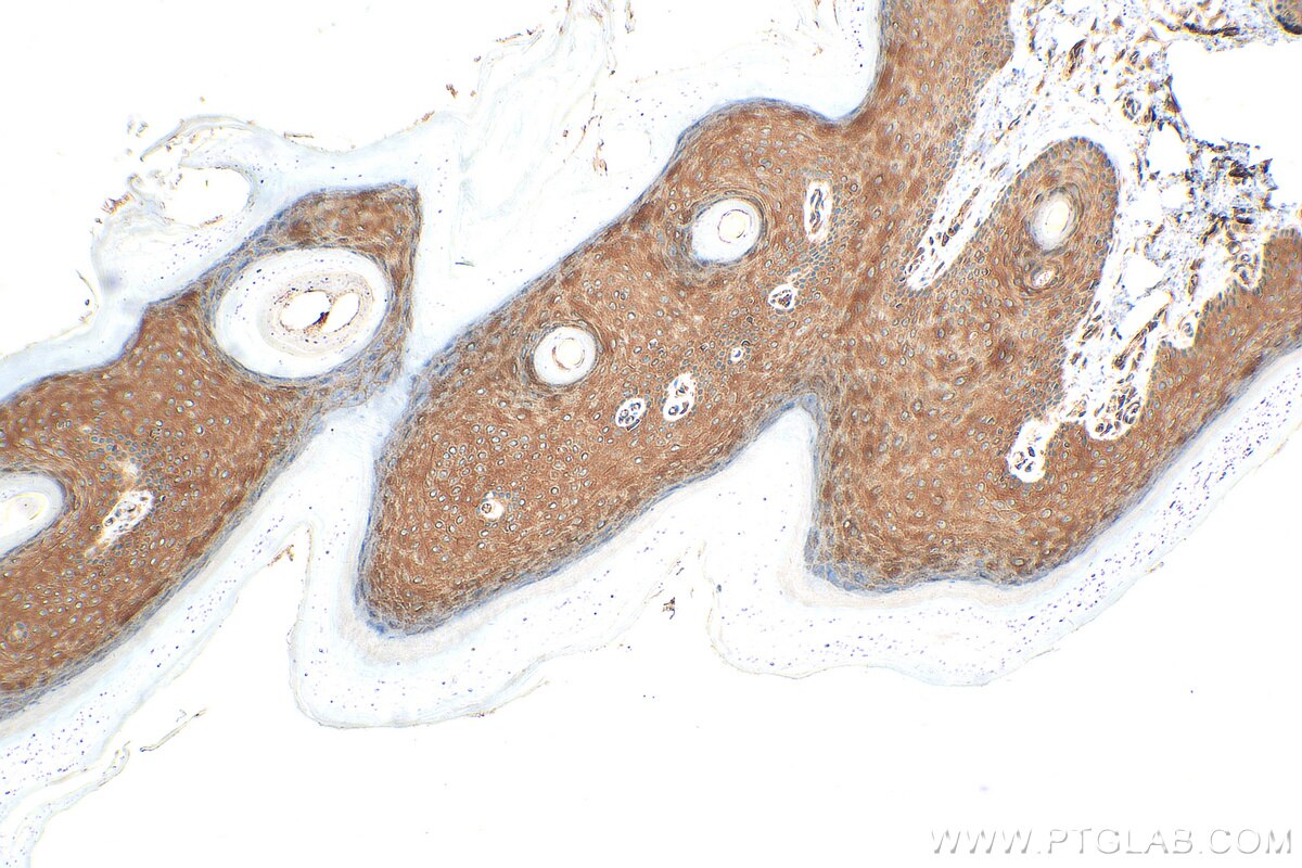 Immunohistochemistry (IHC) staining of rat skin tissue using PPL Polyclonal antibody (31296-1-AP)