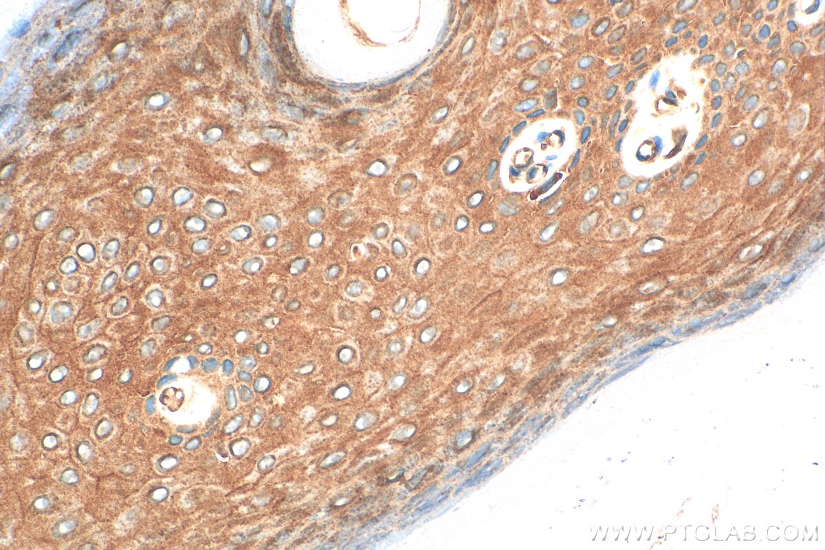 Immunohistochemistry (IHC) staining of rat skin tissue using PPL Polyclonal antibody (31296-1-AP)