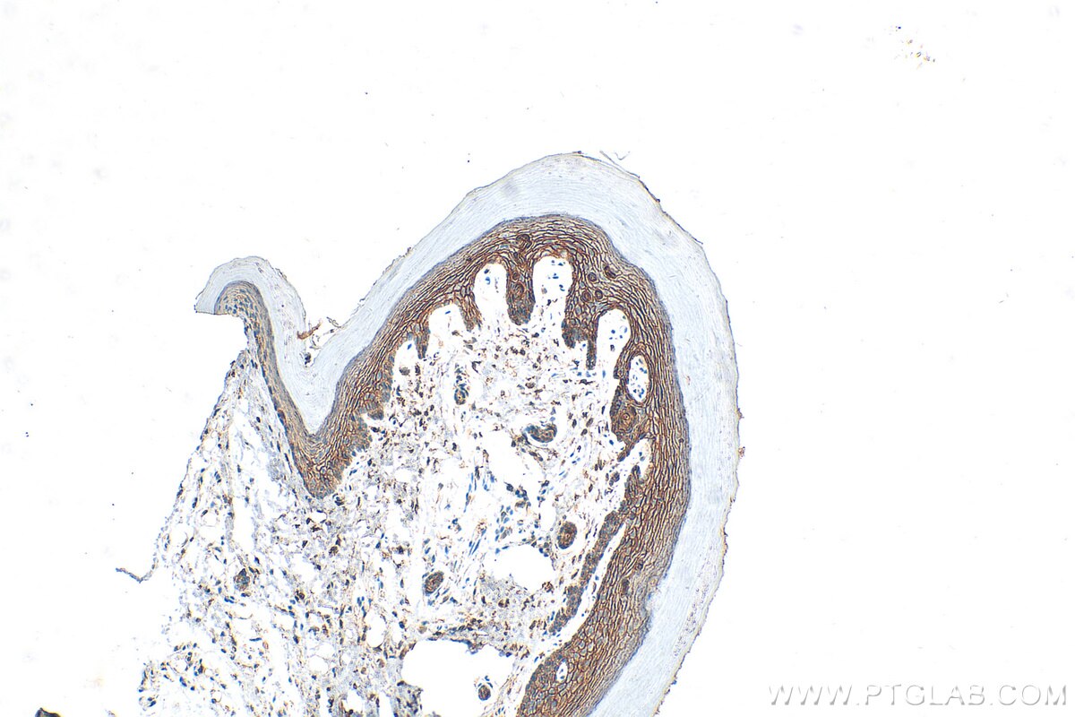 Immunohistochemistry (IHC) staining of mouse skin tissue using PPL Polyclonal antibody (31296-1-AP)