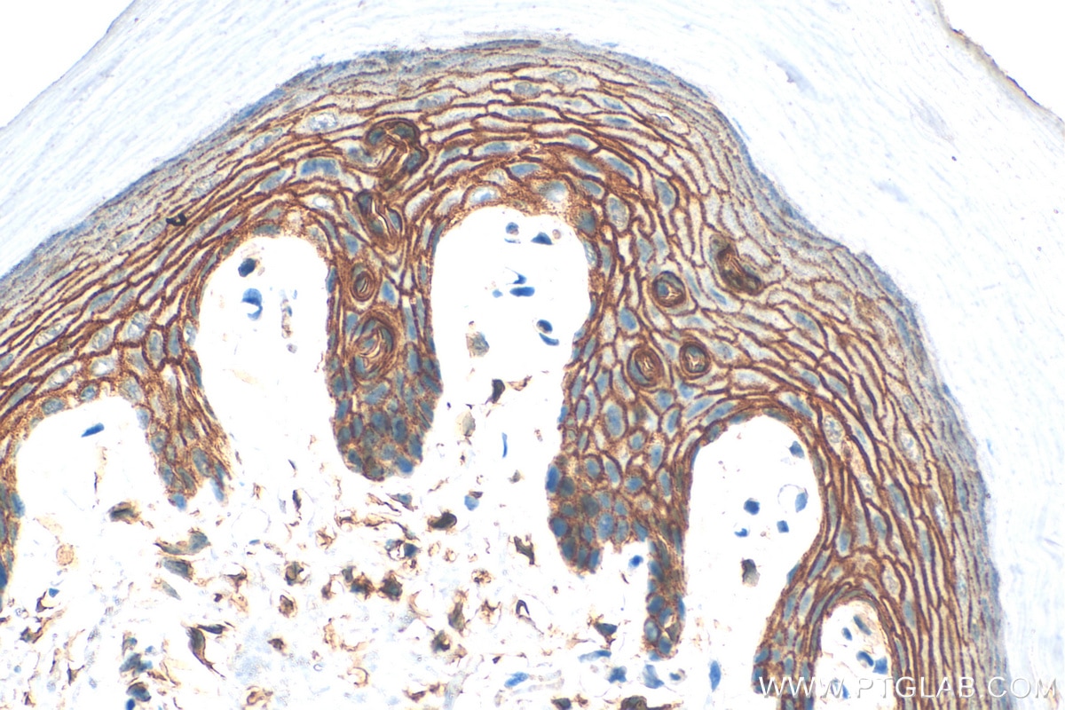 Immunohistochemistry (IHC) staining of mouse skin tissue using PPL Polyclonal antibody (31296-1-AP)