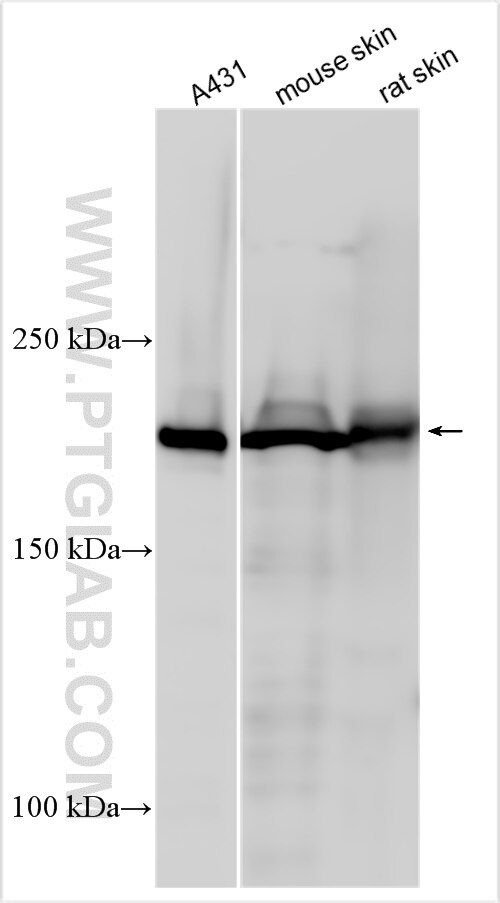 Western Blot (WB) analysis of various lysates using PPL Polyclonal antibody (31296-1-AP)