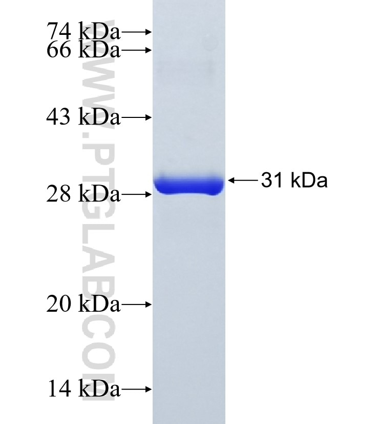 PPL fusion protein Ag34978 SDS-PAGE
