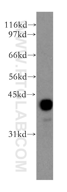 Western Blot (WB) analysis of human liver tissue using PPM1A Polyclonal antibody (12961-1-AP)