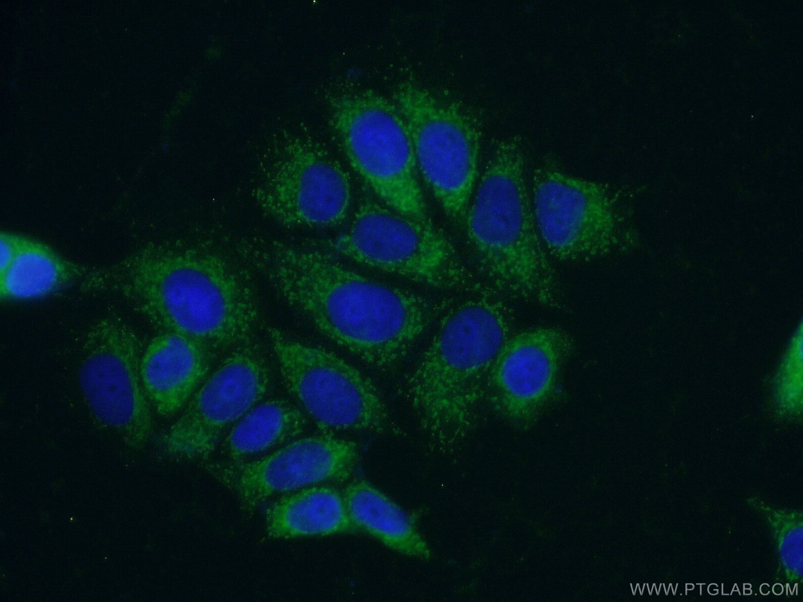 Immunofluorescence (IF) / fluorescent staining of MCF-7 cells using PPM1B Polyclonal antibody (13193-1-AP)