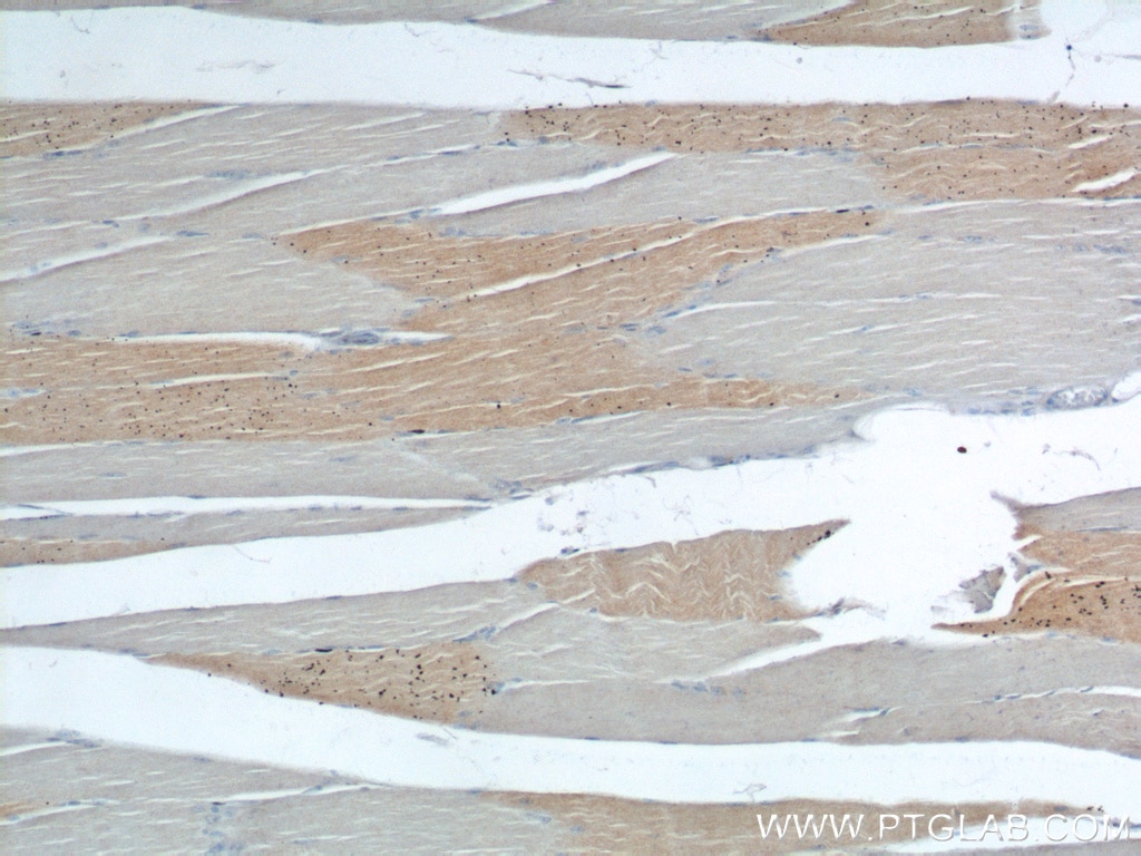 Immunohistochemistry (IHC) staining of human skeletal muscle tissue using PPM1B Polyclonal antibody (13193-1-AP)