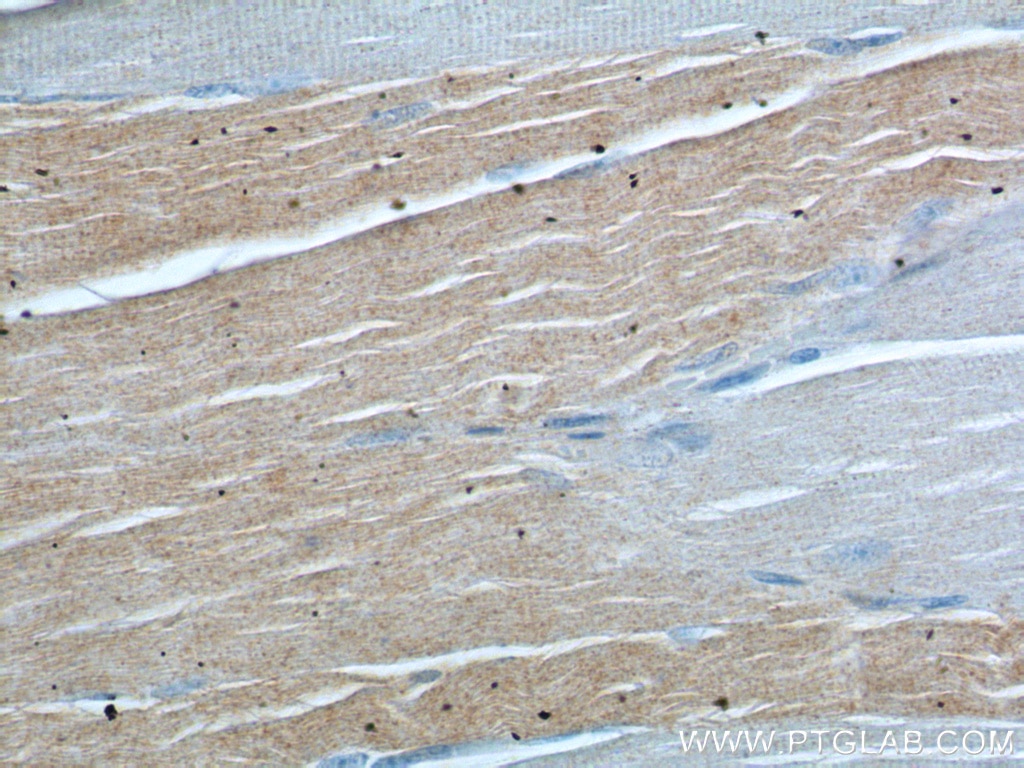 Immunohistochemistry (IHC) staining of human skeletal muscle tissue using PPM1B Polyclonal antibody (13193-1-AP)