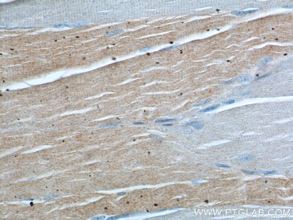 IHC staining of human skeletal muscle using 13193-1-AP