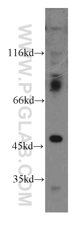 PPM1B