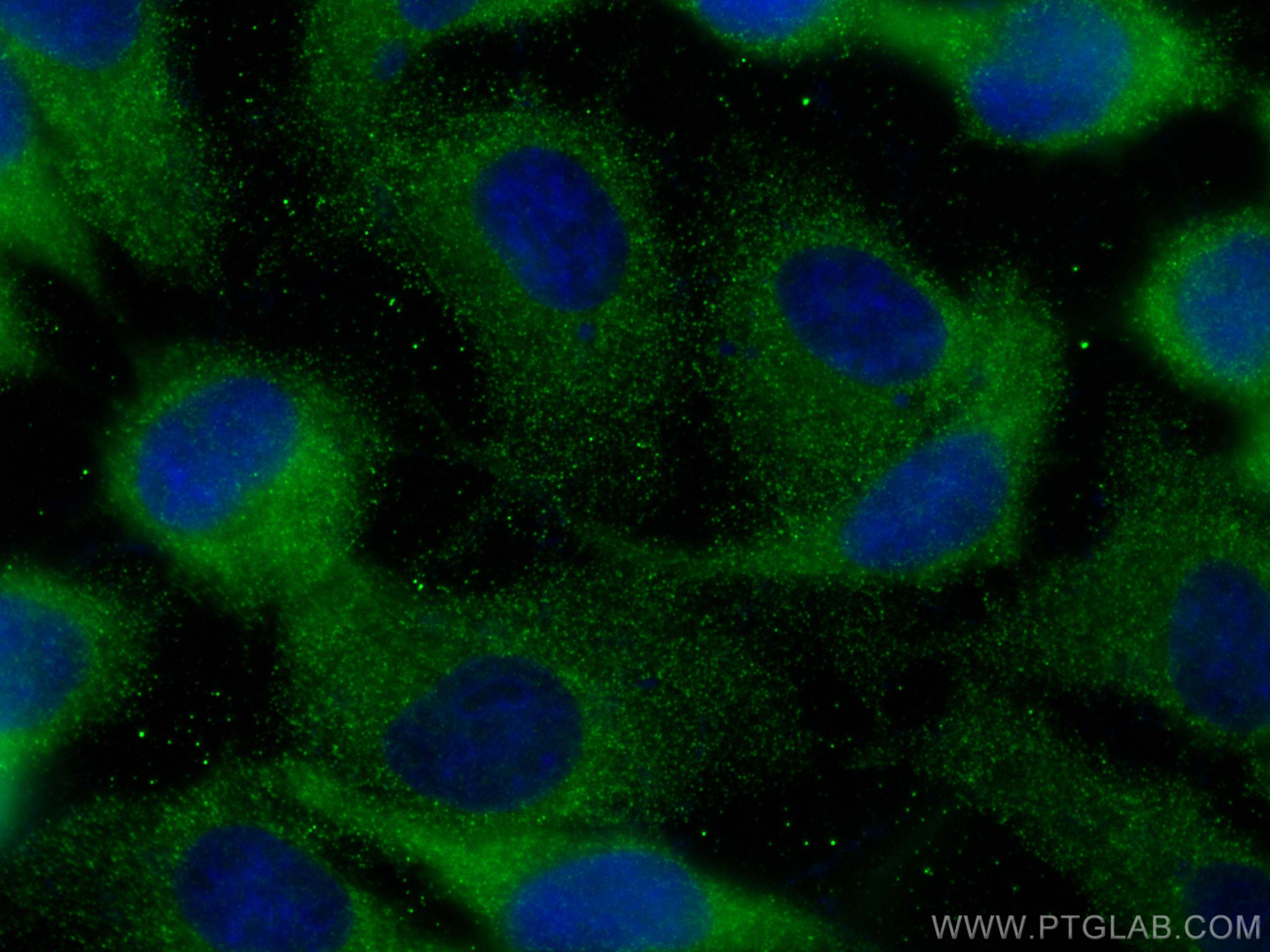 Immunofluorescence (IF) / fluorescent staining of A431 cells using PPM1B Monoclonal antibody (67647-1-Ig)