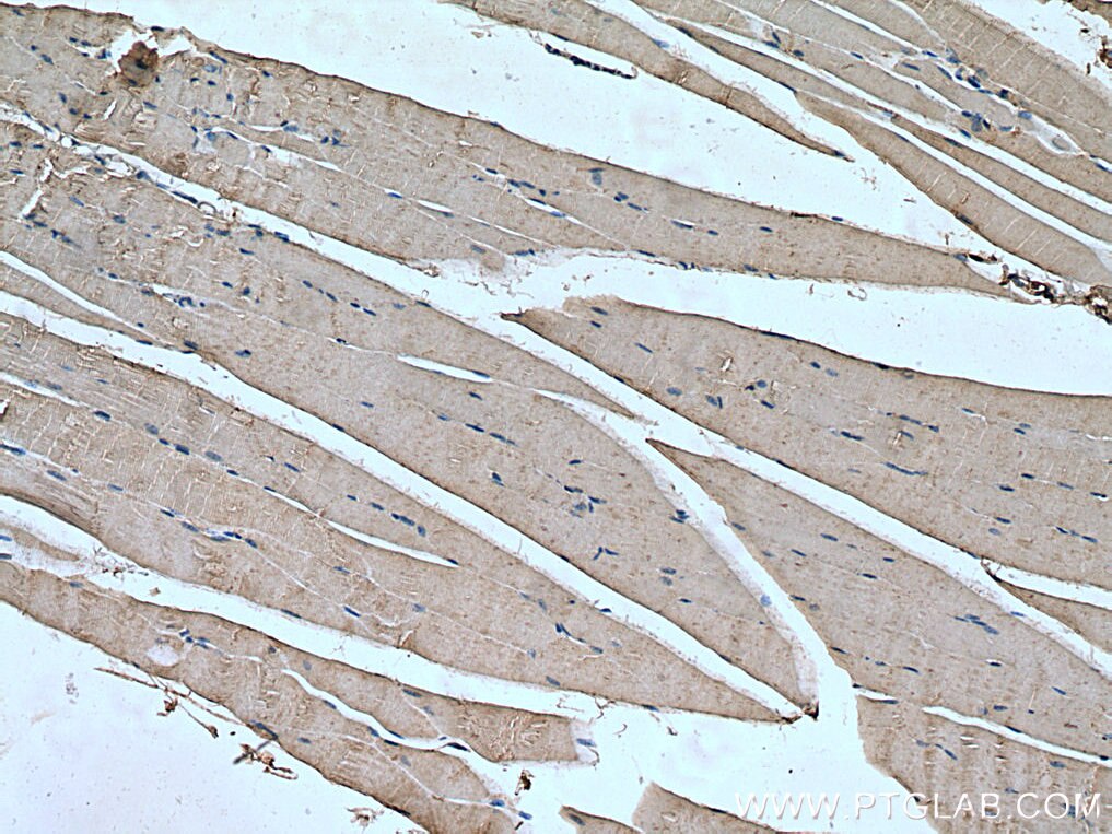 Immunohistochemistry (IHC) staining of mouse skeletal muscle tissue using PPM1B Monoclonal antibody (67647-1-Ig)