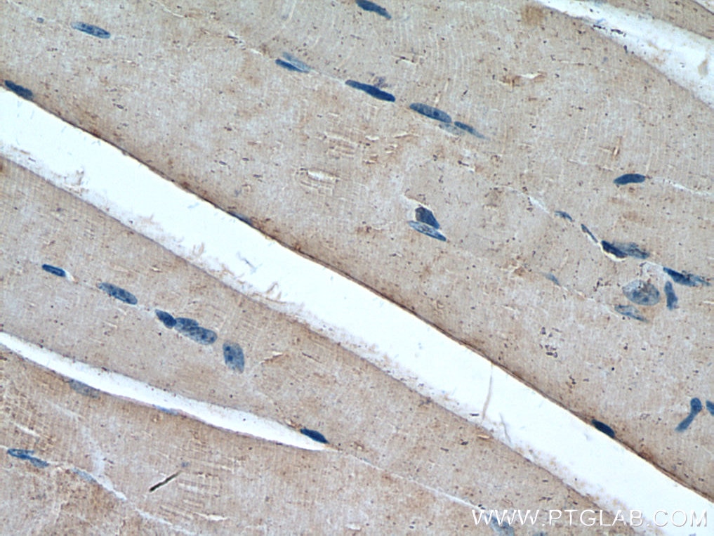 IHC staining of mouse skeletal muscle using 67647-1-Ig