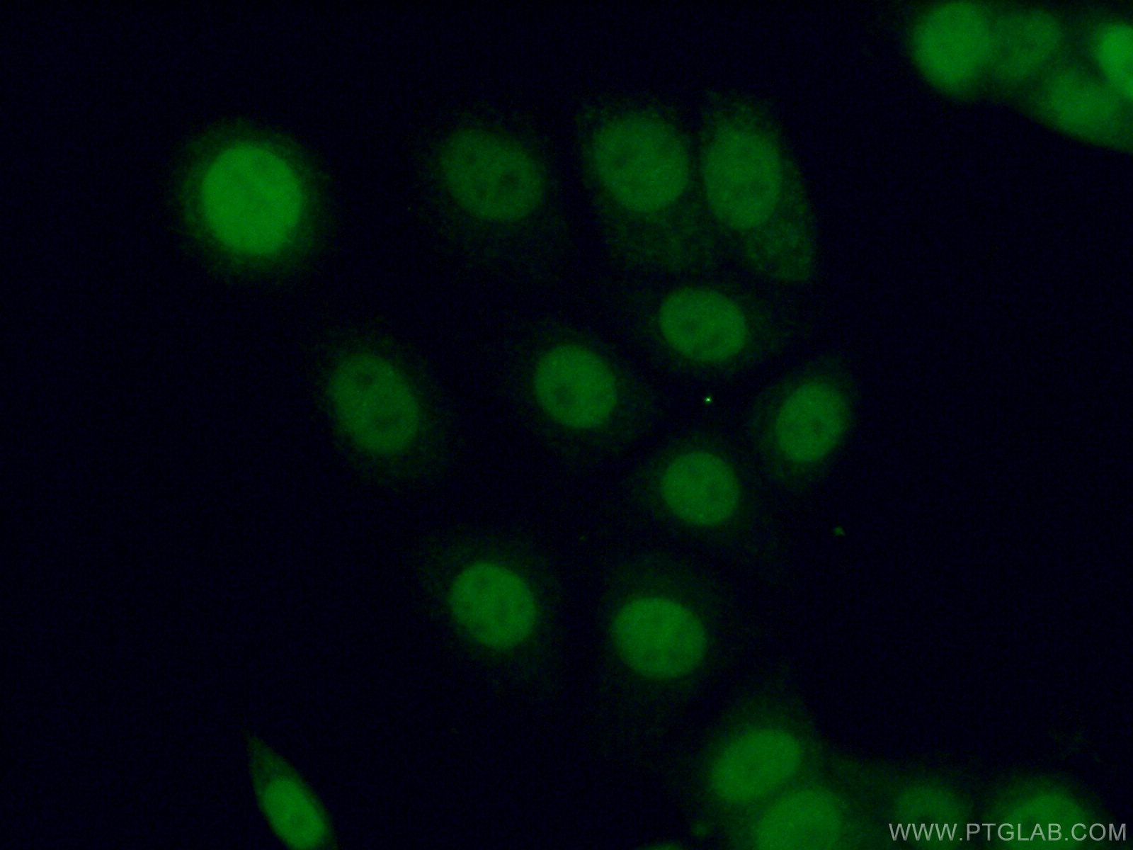 Immunofluorescence (IF) / fluorescent staining of MCF-7 cells using PPM1D Polyclonal antibody (26532-1-AP)
