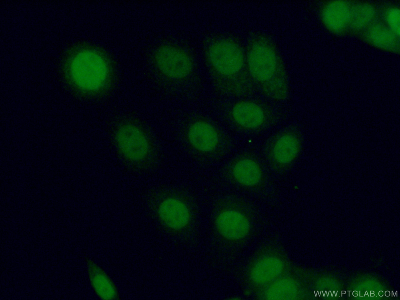 IF Staining of MCF-7 using 26532-1-AP