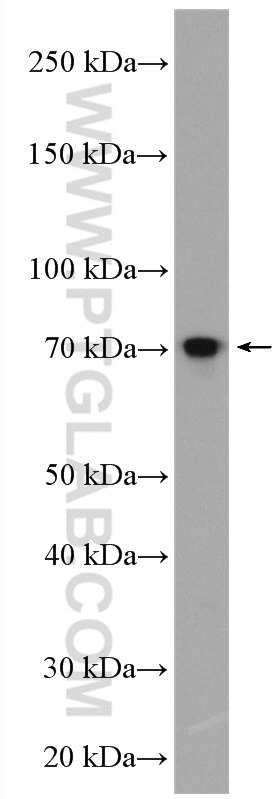Western Blot (WB) analysis of MCF-7 cells using PPM1D Polyclonal antibody (26532-1-AP)