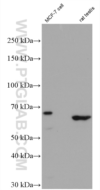 Western Blot (WB) analysis of MCF-7 cells using PPM1D Polyclonal antibody (26532-1-AP)