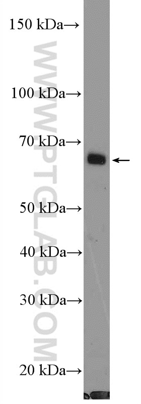 Western Blot (WB) analysis of mouse lung tissue using PPM1D Polyclonal antibody (26532-1-AP)