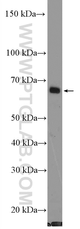 WB analysis of mouse lung using 26532-1-AP