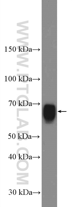 Western Blot (WB) analysis of rat testis tissue using PPM1D Polyclonal antibody (26532-1-AP)