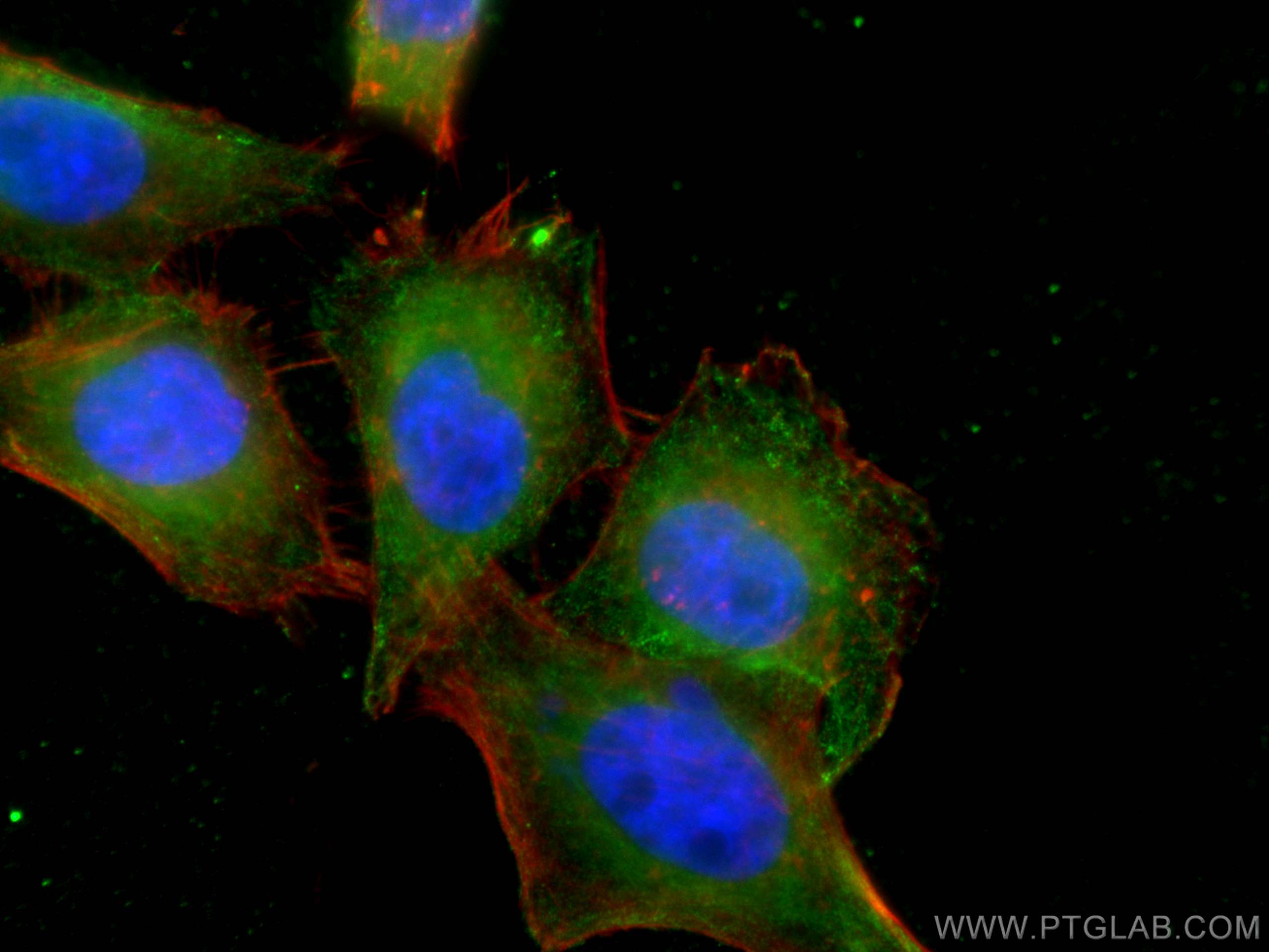 Immunofluorescence (IF) / fluorescent staining of HepG2 cells using PPM1D Monoclonal antibody (67440-1-Ig)