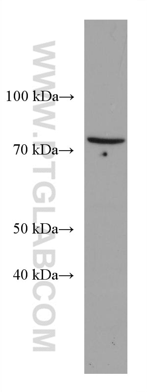 Western Blot (WB) analysis of HEK-293 cells using PPM1D Monoclonal antibody (67440-1-Ig)