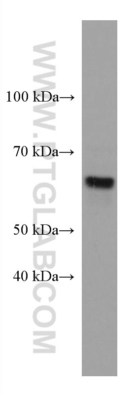 Western Blot (WB) analysis of U2OS cells using PPM1D Monoclonal antibody (67440-1-Ig)