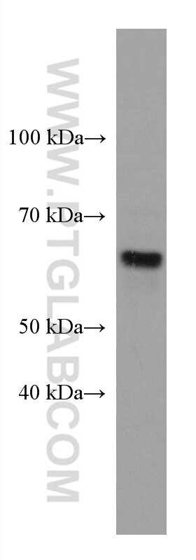 WB analysis of U2OS using 67440-1-Ig