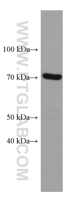 Western Blot (WB) analysis of MCF-7 cells using PPM1D Monoclonal antibody (67440-1-Ig)