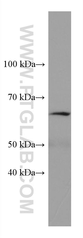 Western Blot (WB) analysis of pig brain tissue using PPM1D Monoclonal antibody (67440-1-Ig)