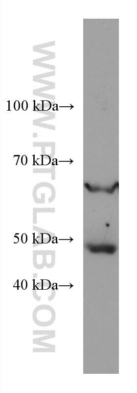 Western Blot (WB) analysis of rat brain tissue using PPM1D Monoclonal antibody (67440-1-Ig)