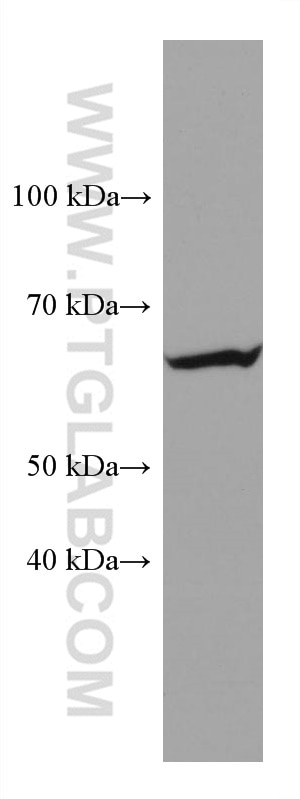 Western Blot (WB) analysis of mouse brain tissue using PPM1D Monoclonal antibody (67440-1-Ig)