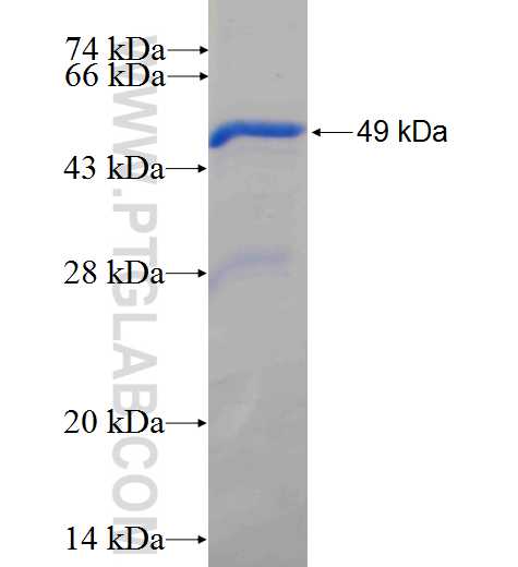 PPM1D fusion protein Ag24751 SDS-PAGE