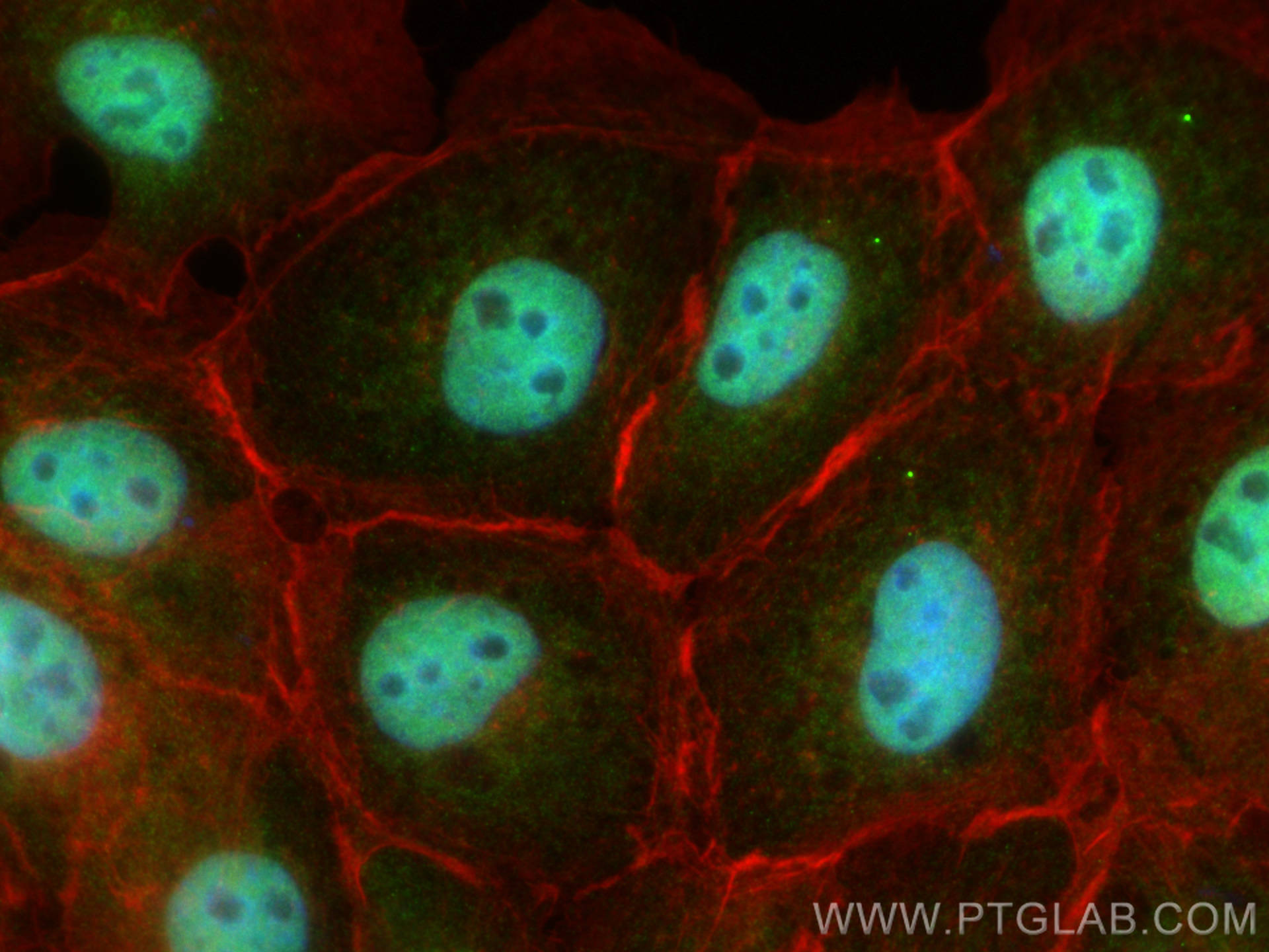 Immunofluorescence (IF) / fluorescent staining of A431 cells using PPM1E Polyclonal antibody (25089-1-AP)