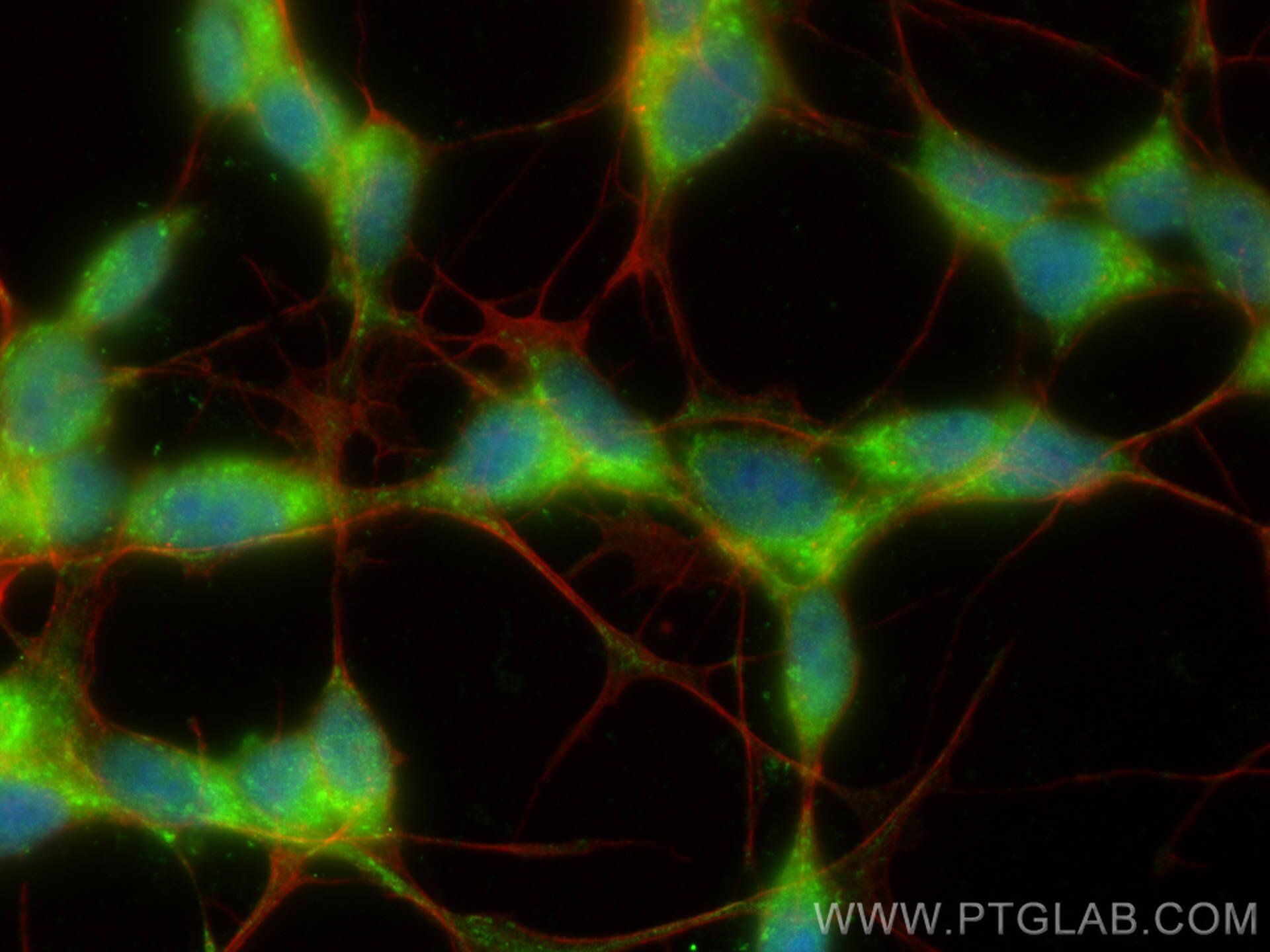 Immunofluorescence (IF) / fluorescent staining of SH-SY5Y cells using PPM1E Polyclonal antibody (25089-1-AP)